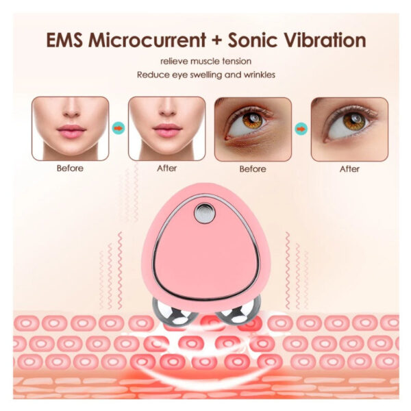 EMS Rejuvenation Face Lift Device and Massager (USB) - Image 5